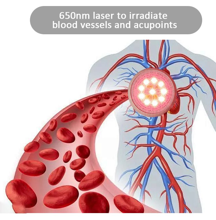 Laser Mechanism Diagram