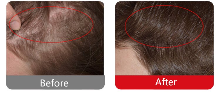 HD-CurePro01 Package